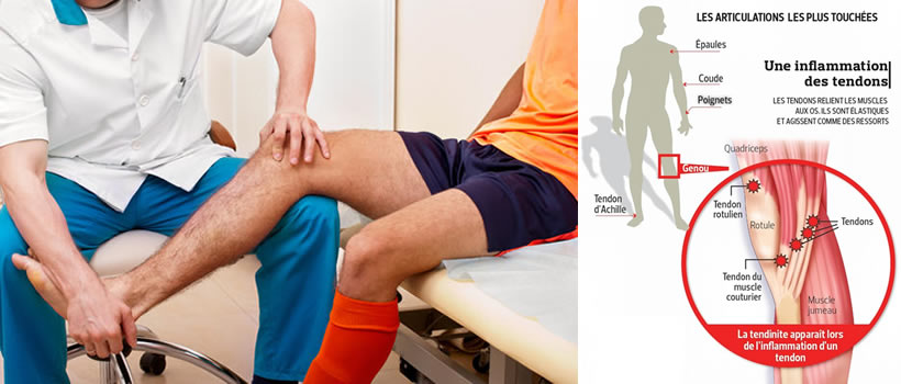 Comment diagnostiquer une douleur au genou ?