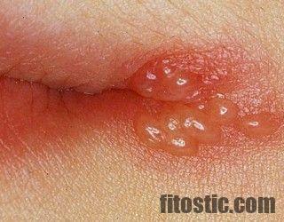 Comment Faire Partir Un Bouton En 5 Minutes Comment Faire Partir Un Bouton En 5 Minutes