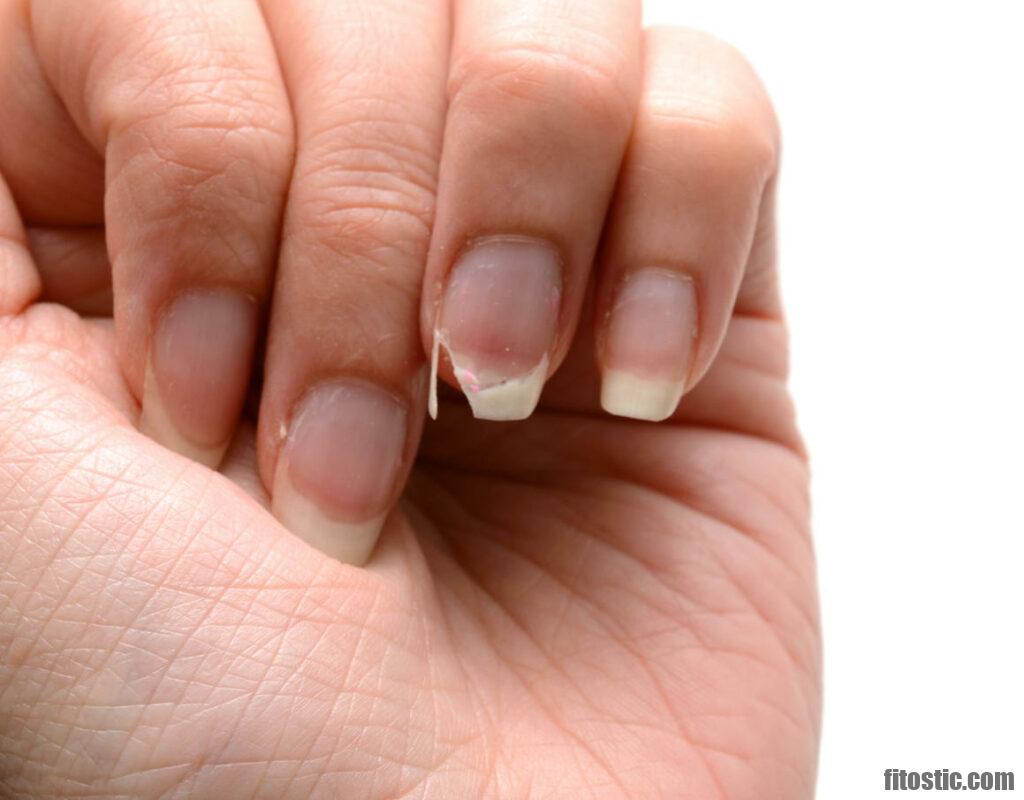 Comment Renforcer Des Ongles Mous Et Cassants