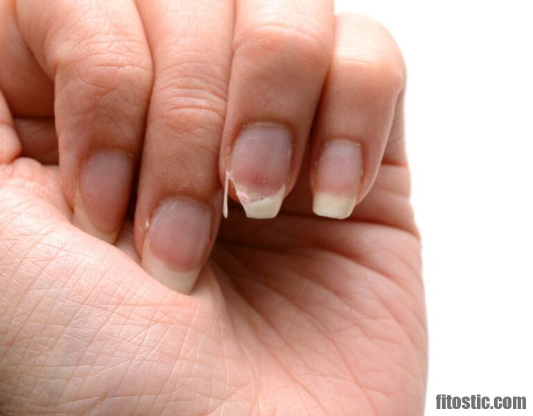 Comment Renforcer Des Ongles Mous Et Cassants