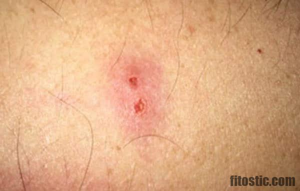 Comment Savoir Quel Type De Bouton