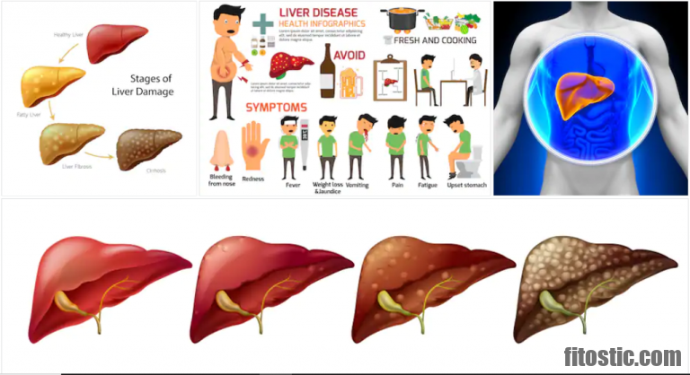 Comment Attrape-t-on une cirrhose du foie ?