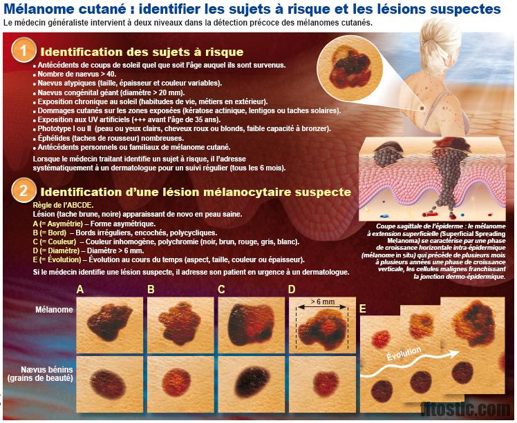 Comment Meurt-on d'un cancer de la peau ?