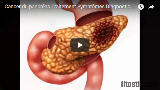 Comment Meurt-on d'un cancer du pancréas ?