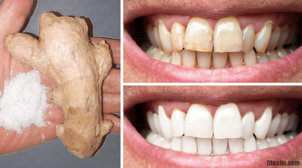 Comment blanchir les dents en deux minutes ?