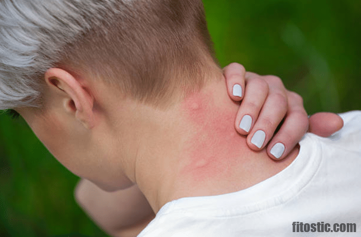 Comment calmer les bouffées de chaleur naturellement ?