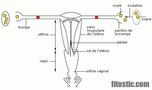 Comment detecter une infection utérine ?