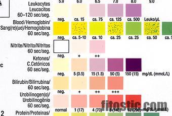 Comment détecter une pubalgie ?