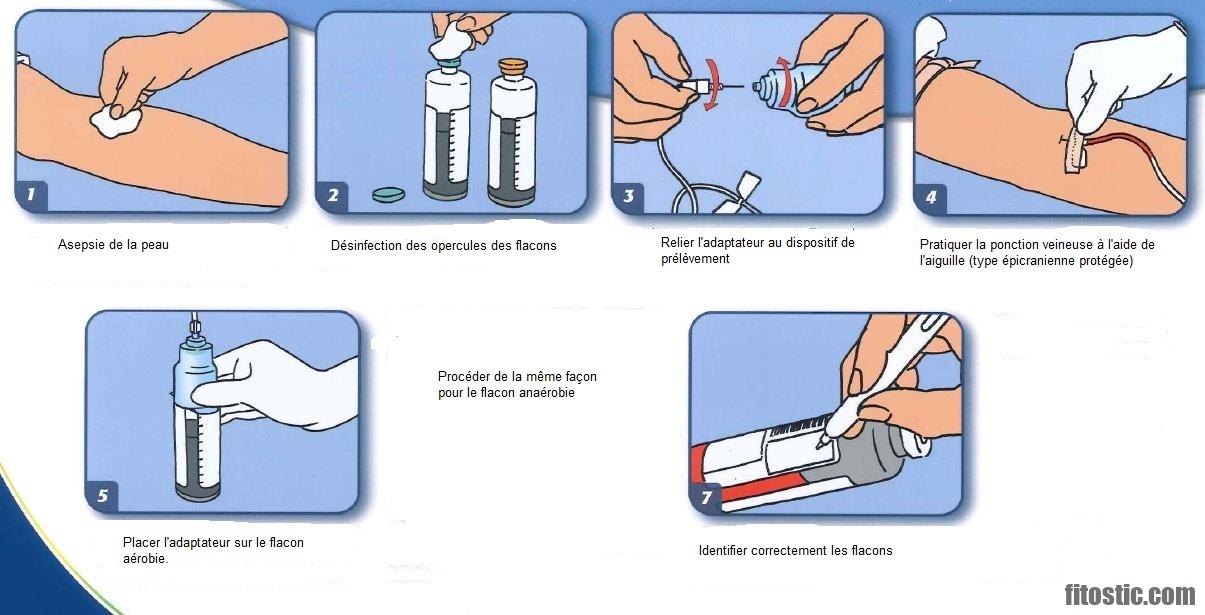 Comment diminuer l'adénomyose ?