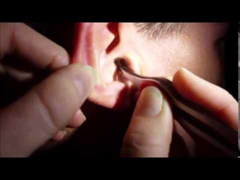 Comment Enlever 1 Bouchon De Cerumen Fitostic Com Sport Mode Beaute Lifestyle Magazine Comment Enlever 1 Bouchon De Cerumen Fitostic Com Sport Mode Beaute Lifestyle Magazine