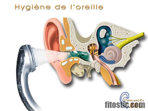 Comment Enlever Un Bouchon D Eau Dans L Oreille Fitostic Com Sport Mode Beaute Lifestyle Magazine Comment Enlever Un Bouchon D Eau Dans L Oreille Fitostic Com Sport Mode Beaute Lifestyle Magazine