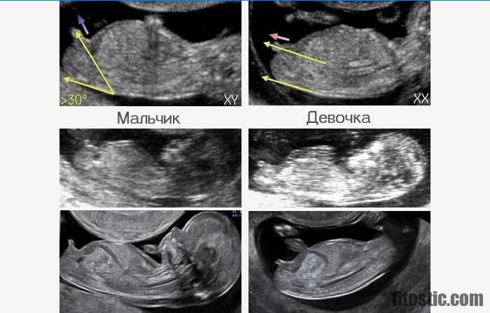 Comment est le bébé à la 35e semaine de grossesse ?