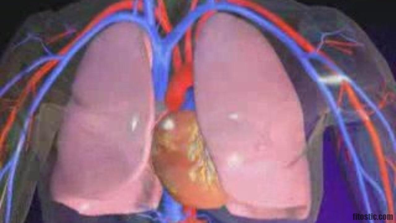 Comment évolue une embolie pulmonaire ?