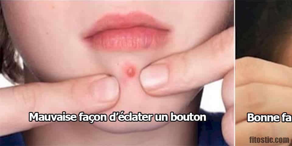 Comment faire partir un point de sang sur la peau ?