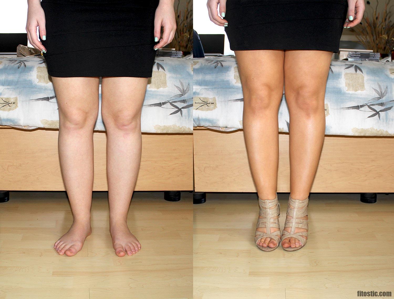 Comment faire pour avoir des jambes droites ?