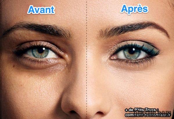 Comment faire pour enlever les taches dans les yeux ?