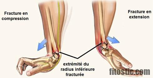 Comment guérir de l'arythmie ?