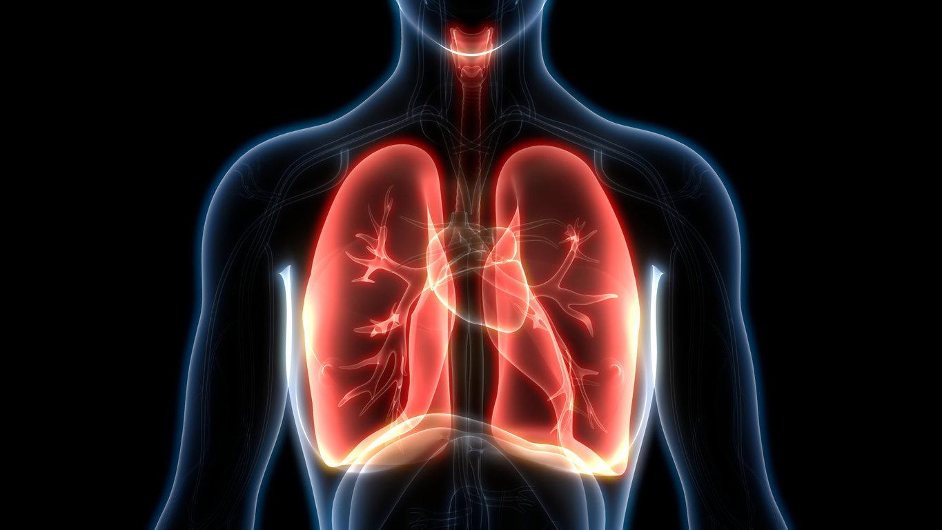 Comment guérir d'un pneumothorax ?