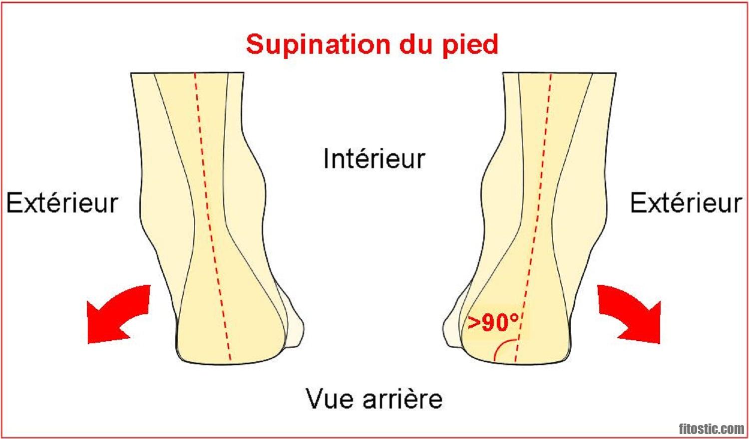 Comment guérir genu valgum ?