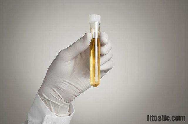 Comment mesurer l'acidité de l'urine ?