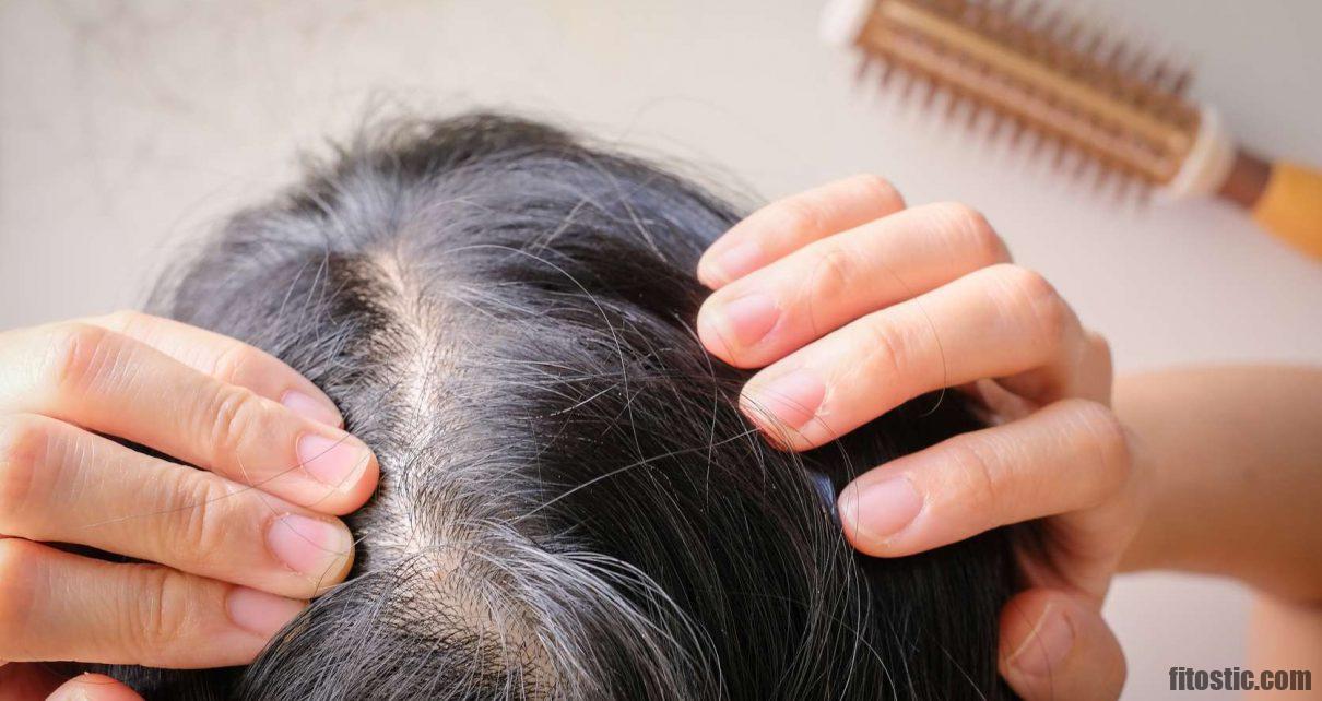 Comment ralentir la chute des cheveux naturellement ?