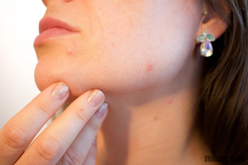 Comment reconnaître une allergie au visage ?