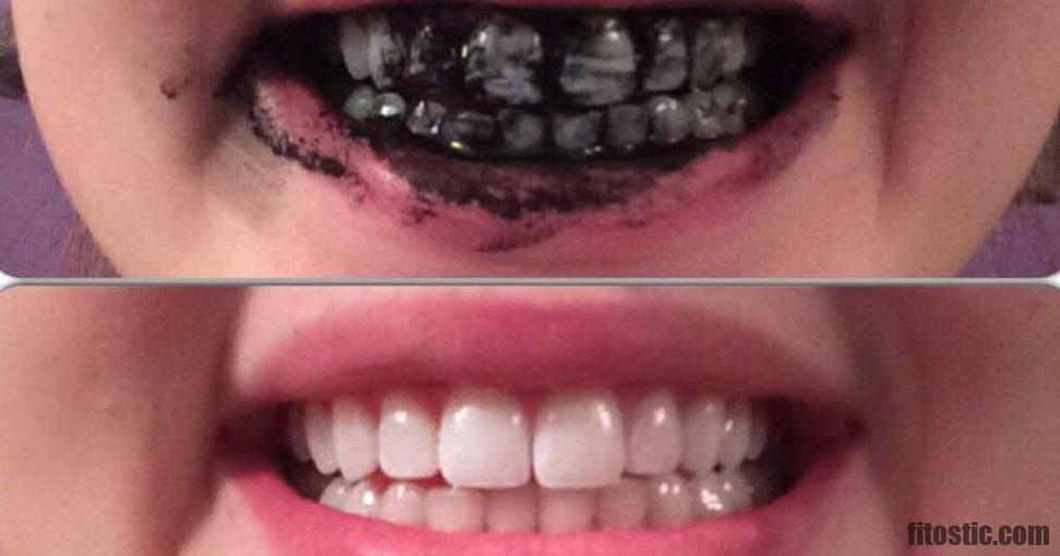Comment renforcer naturellement ses dents ?