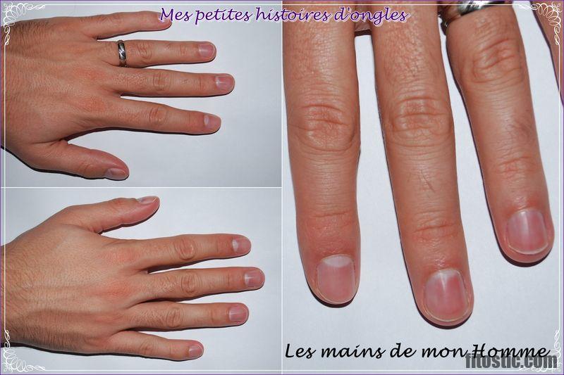 Comment réparer la matrice d'un ongle ?