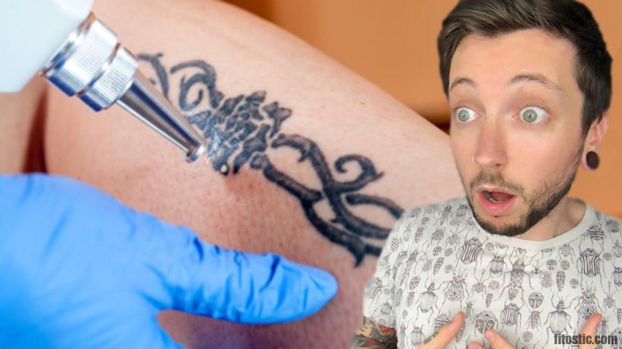 Comment retirer un tatouage Soi-même ?