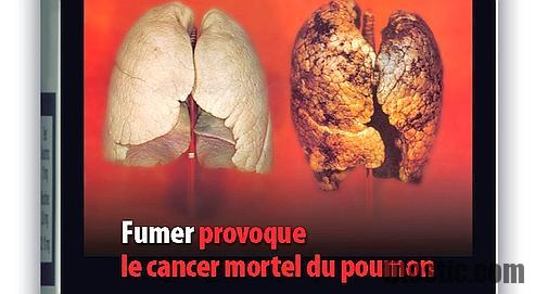 Comment s Ecoeurer de la cigarette ?