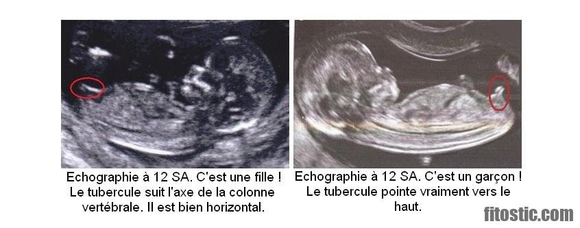 Comment savoir si c'est une fille ou un garçon sans échographie ?