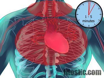 Comment savoir si douleur cardiaque ou musculaire ?