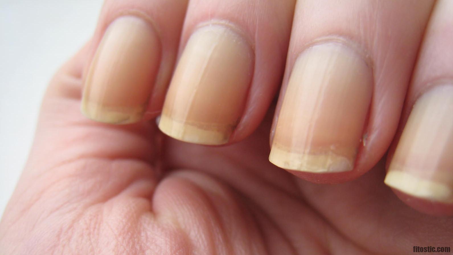 Comment savoir si nos ongles sont en bonne santé ?