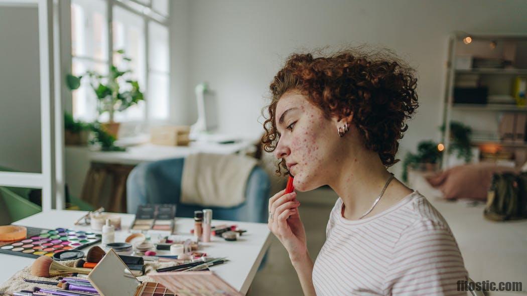 Comment savoir si on a de l'acné hormonal ?