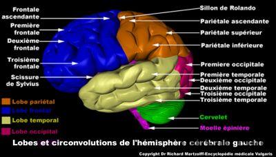 Comment savoir si on a des vers dans le cerveau ?