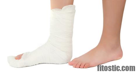 Comment savoir si on a une fracture de fatigue au pied ?