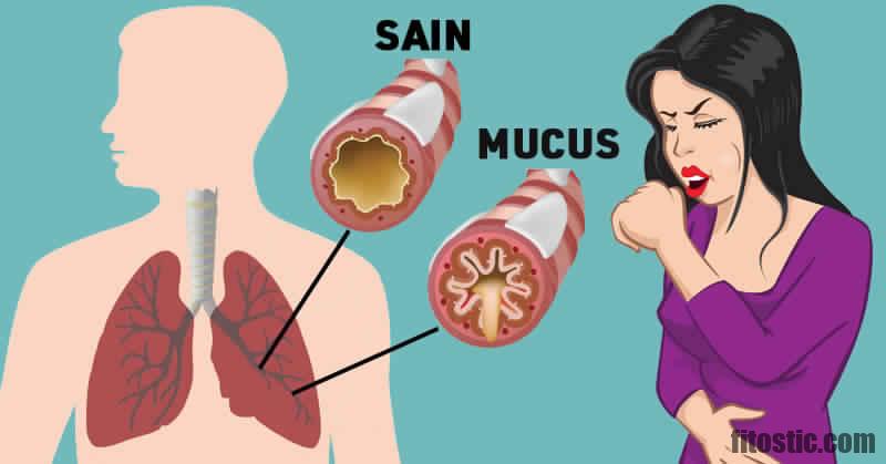 Comment se débarrasser du mucus dans les bronches ?