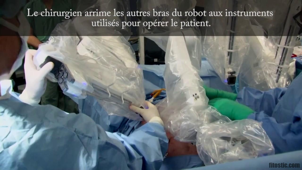 Comment se déroule une Rhizolyse ?