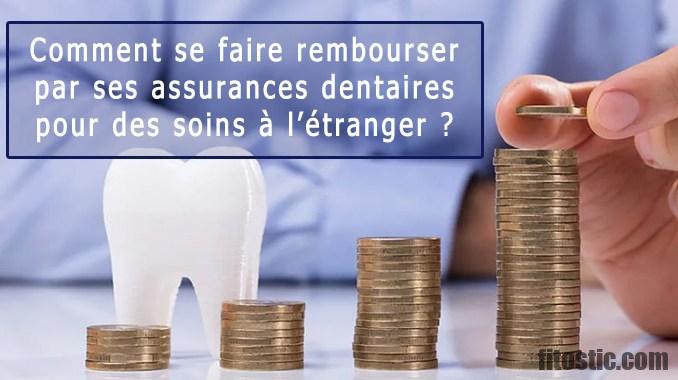 Comment se faire rembourser ses facettes dentaires ?