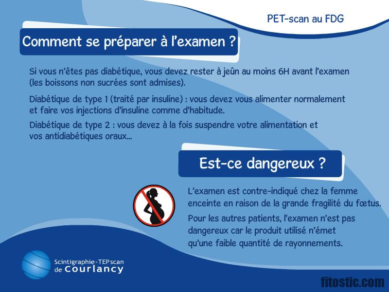 Comment se passe l'examen du spermogramme ?