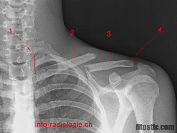 Comment s'étirer la clavicule ?