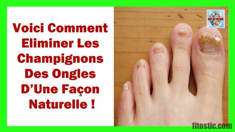 Comment Soigner La Mycose Des Ongles De Pieds ? - Fitostic.com - Sport ...