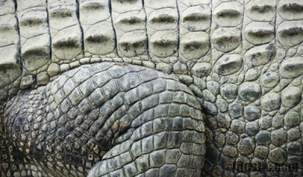 Comment soigner la peau de crocodile sur les jambes ?