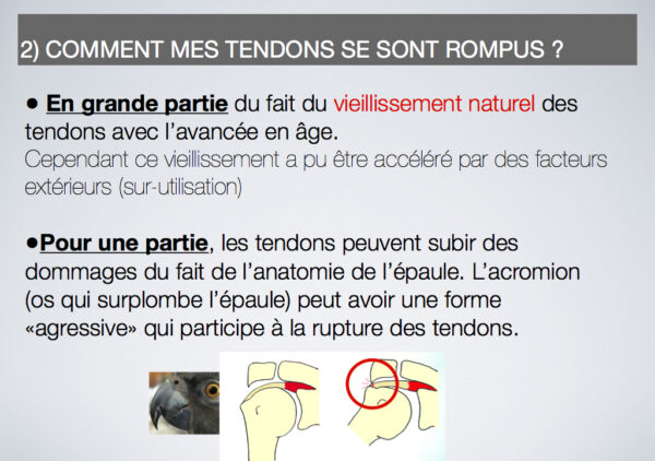 Comment soigner une inflammation du cardia ?  Fitostic.com  Sport