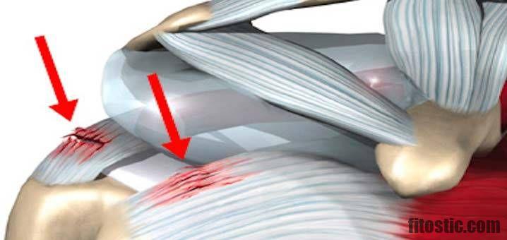 Comment soigner une inflammation du pharynx ?  Fitostic.com  Sport