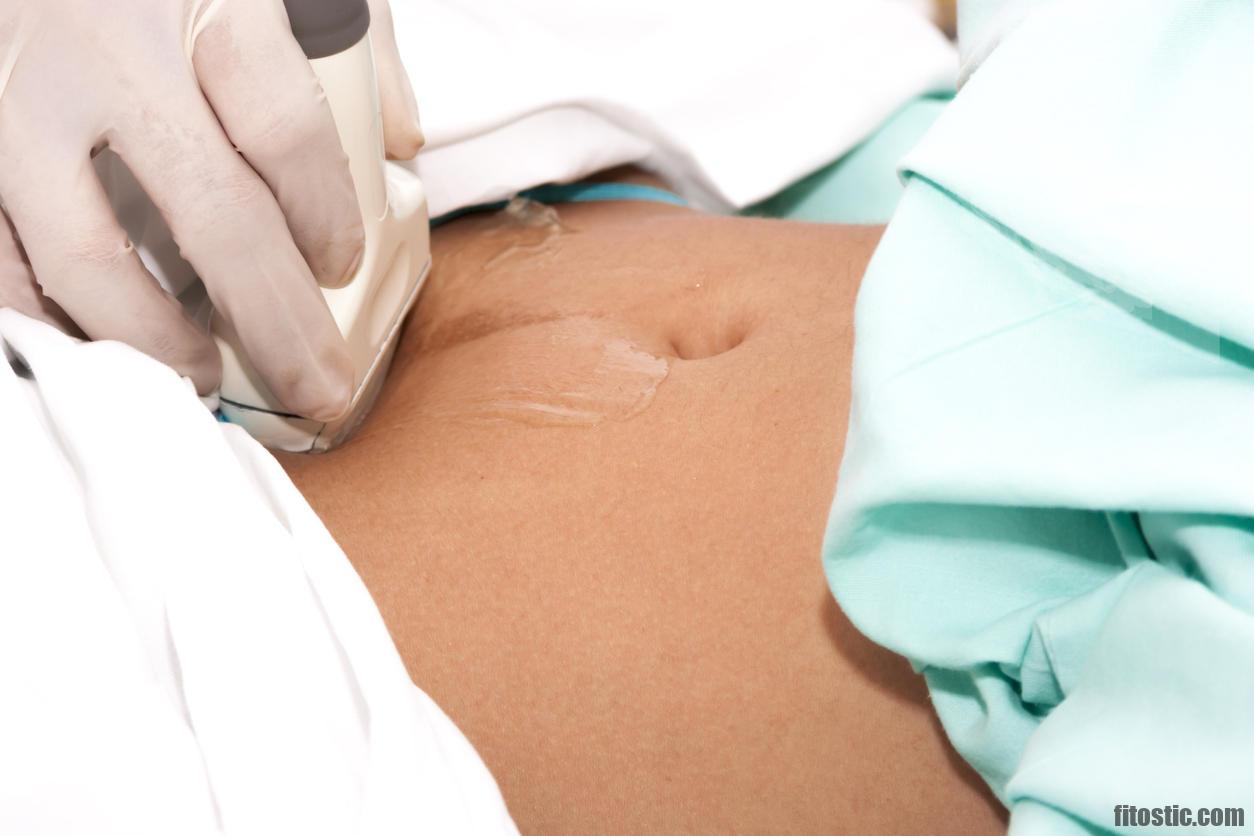 Comment sont les saignement d'une grossesse Extra-utérine ?