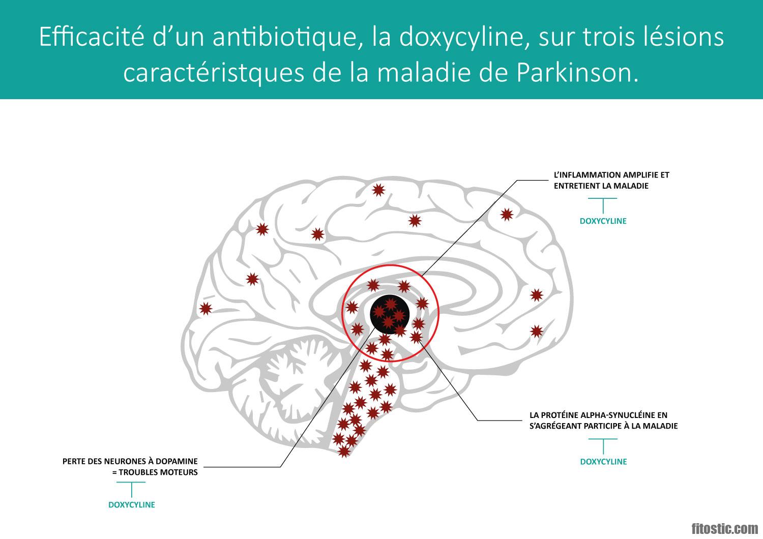 Comment stopper la maladie de Parkinson ?