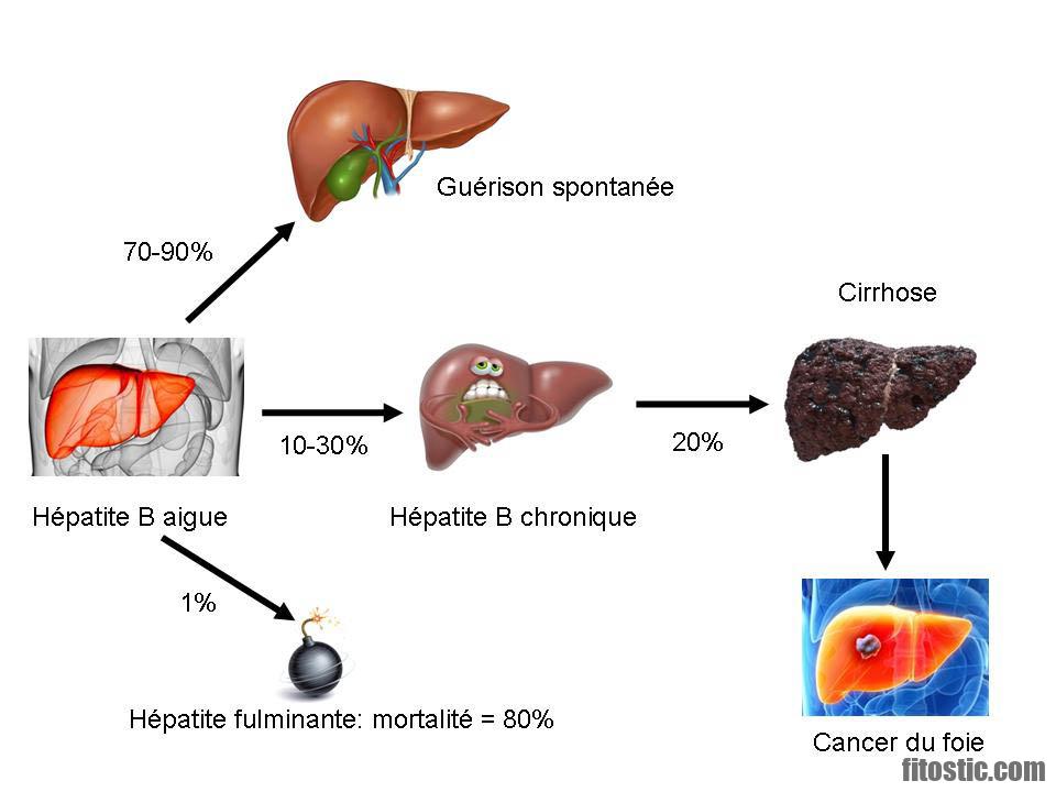 Comment tuer le virus de l'hépatite B ?