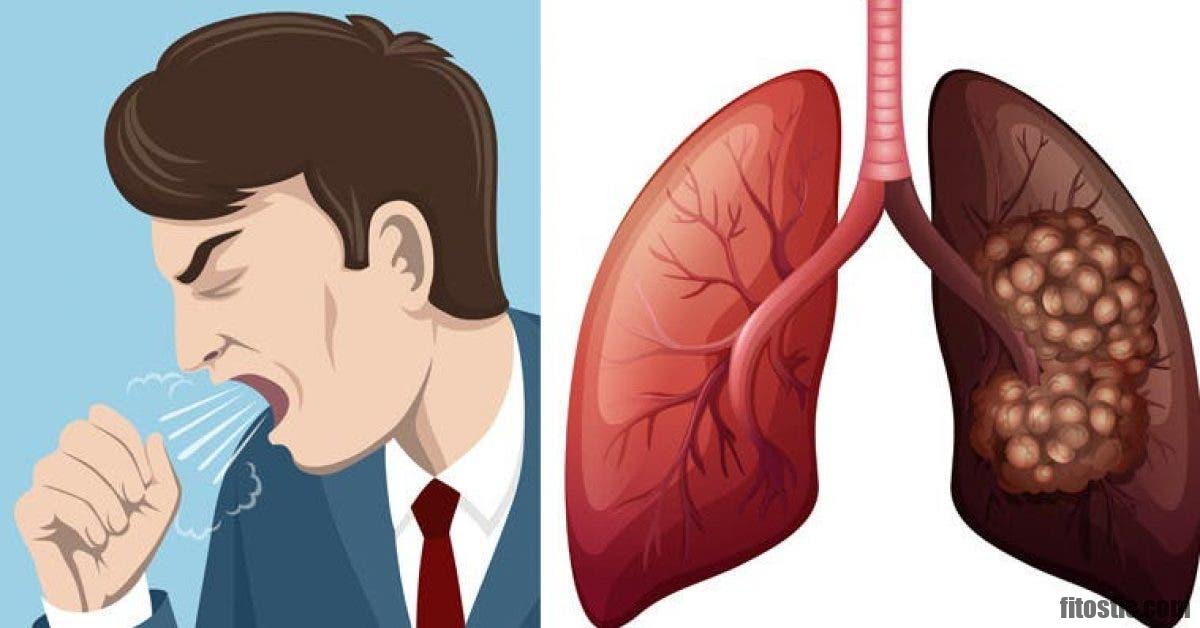 Est-ce que le cancer de la bouche se soigne ?