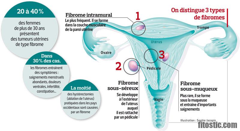 Est-ce que le mal de ventre est un signe de grossesse ?